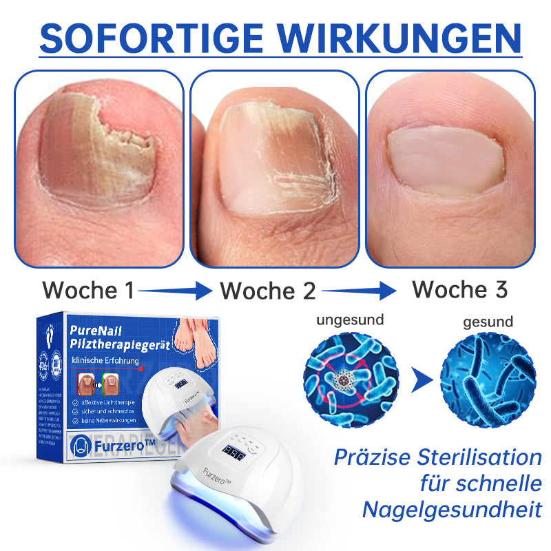 PureNail™ | Lasertherapiegerät gegen Nagelpilz