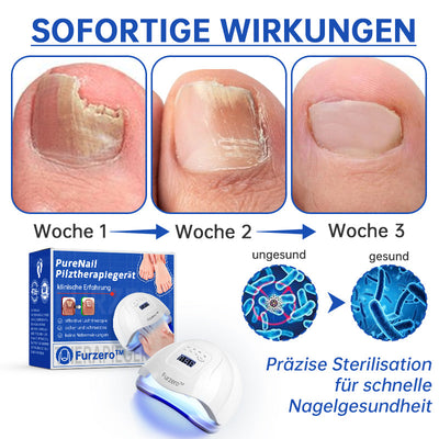 PureNail™ | Lasertherapiegerät gegen Nagelpilz